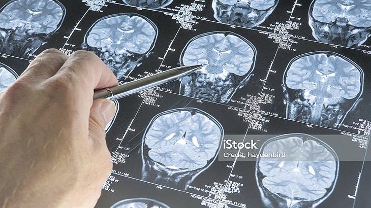 Kovid ‘deli dana’ya yol açıyor mu?