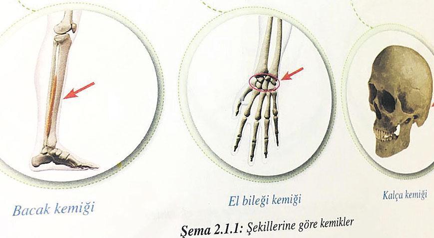 Kafatasına ‘kalça kemiği’ yazıldı