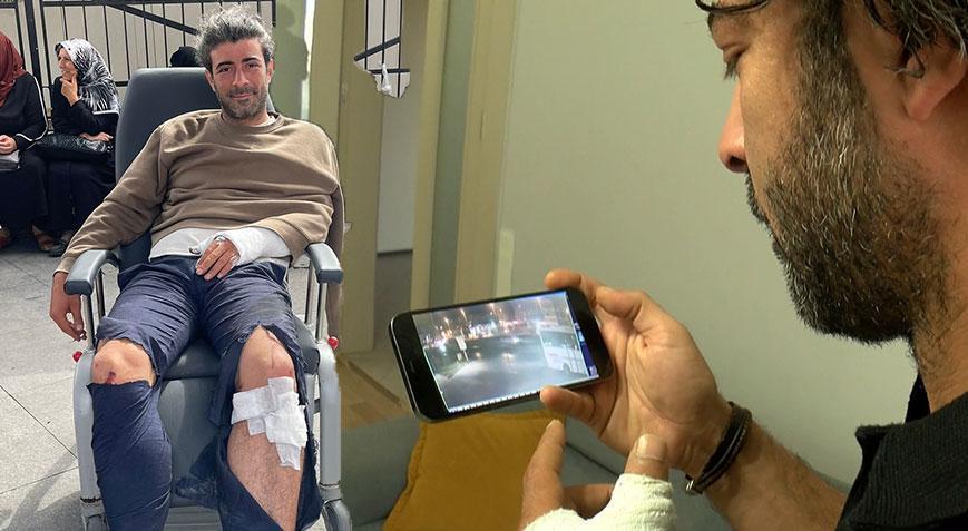 Alkollü sürücü dehşet saçtı! Genç oyuncu ölümden döndü