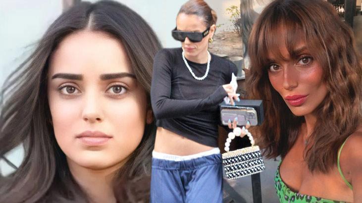 Bestemsu Özdemir’in ‘estetik’ isyanı! ’32 yaşındayım, yüzüm değişiyor’