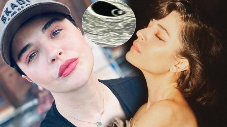 Gonca Vuslateri, ultrason görüntüsünü paylaştı