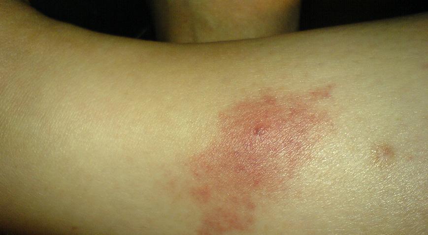 Adana, İzmir ve Ankara’da görüldü! Korkutan salgın uyarısı