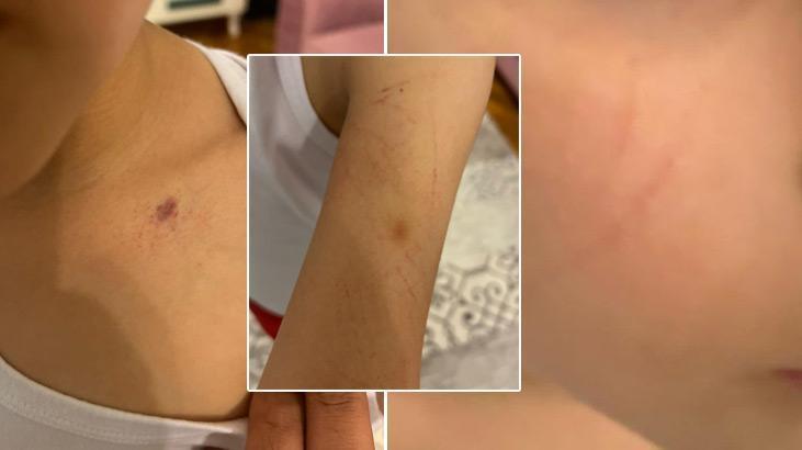 Anaokulunda öğretmenden rezalet! Haberi duyan veli okula koştu