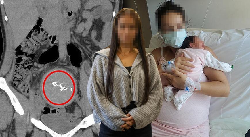 Doğum yaptı, kusma ve ağrı şikayetiyle tekrar hastaneye gitti! 2 yıl sonra büyük şok