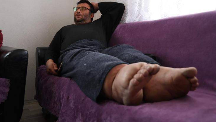 Bu hastalığın tedavisi yok! Bacakları her yıl 7 santim büyüyor