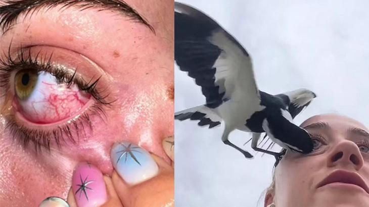 Yürüyüş yaparken saldırdı! Kör olmaktan kıl payı kurtuldu