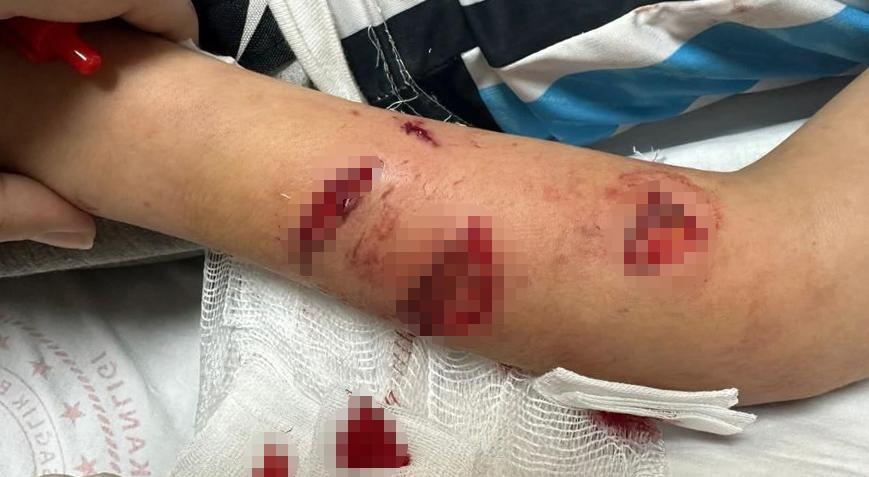 Rize’de dehşet! 12 yaşındaki çocuk, sevdiği köpeğin saldırısına uğradı