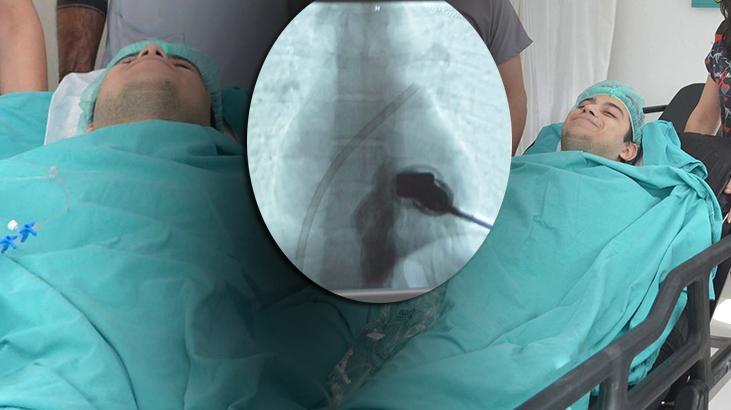 Gönüllü denek oldu! Bu tesadüf hayat kurtardı