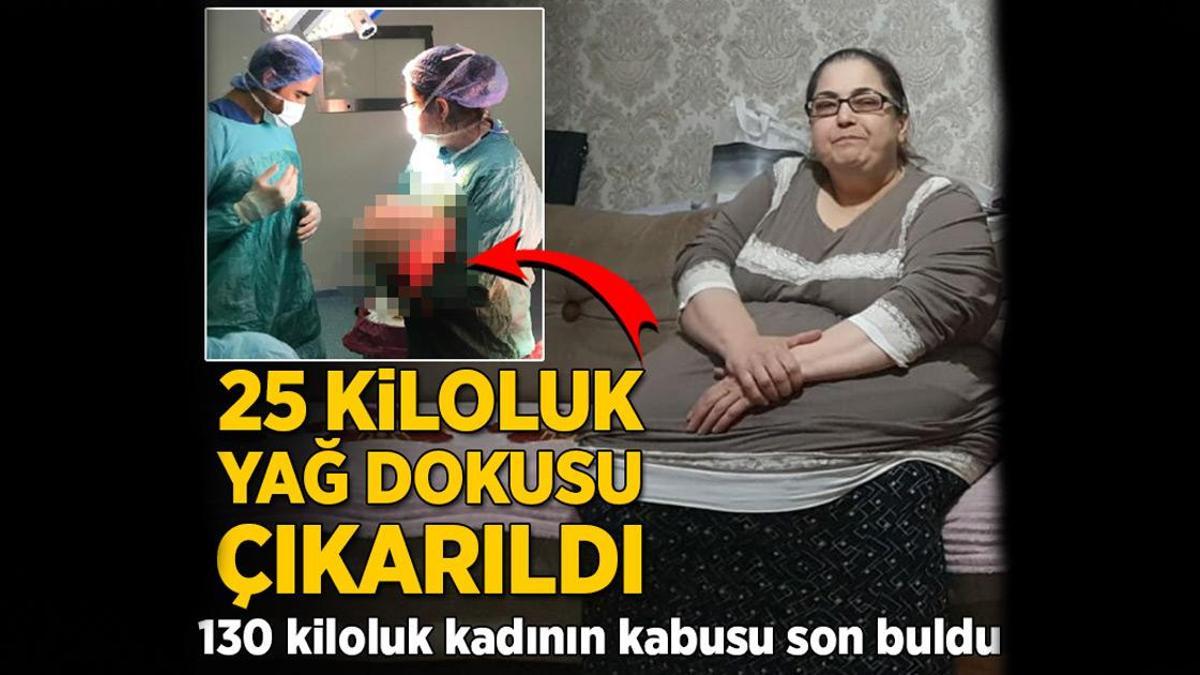 Hareket etmekte güçlük çekiyordu! Vücudundan 25 kiloluk yağ dokusu çıkarıldı