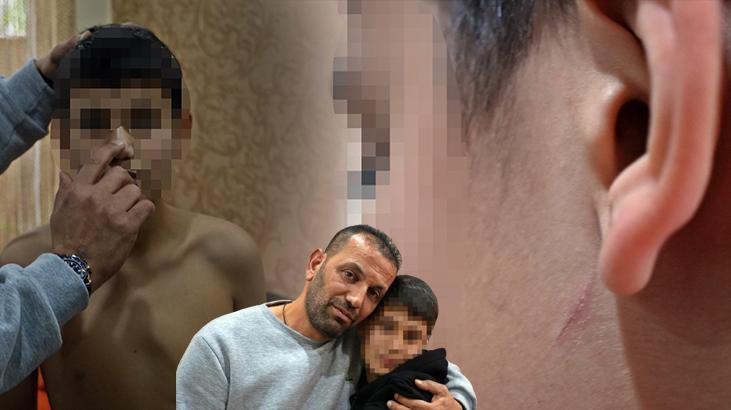 Ailesinin ‘şikayet gelmesin’ sözüyle zorbalığını 2 ay boyunca sakladı