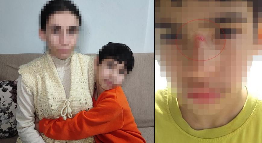 3’üncü sınıf öğrencisine akran zorbalığı! ‘Bana tekme atıyorlar, dövüyorlar’