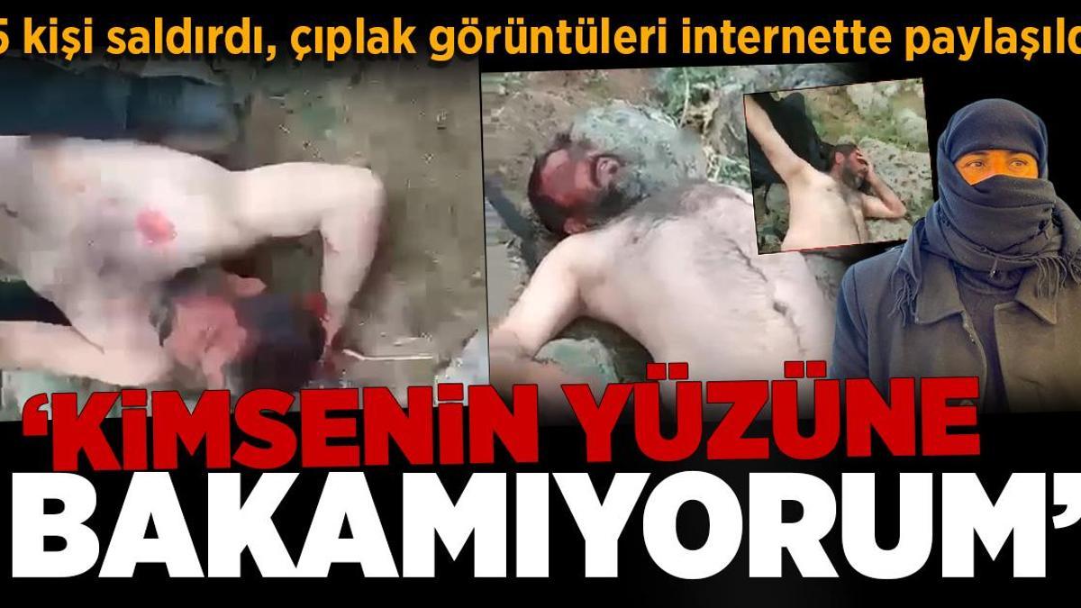 Dövüldü, çıplak görüntüleri paylaşıldı: Kimsenin yüzüne bakamıyorum