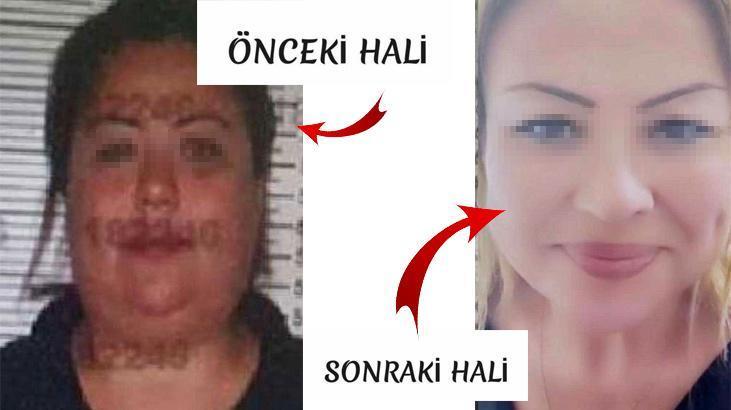 Estetikle kardeşinin yerine geçti!