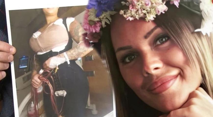 İsveç’ten İstanbul’a gelerek 3 estetik operasyon geçirdi! 1 gün sonra ölü bulundu