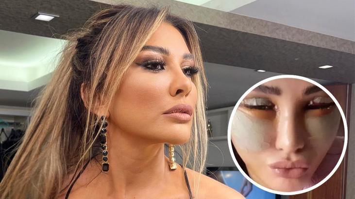 9 saatlik ameliyata girmişti! Operasyonun bedeli dudak uçuklattı