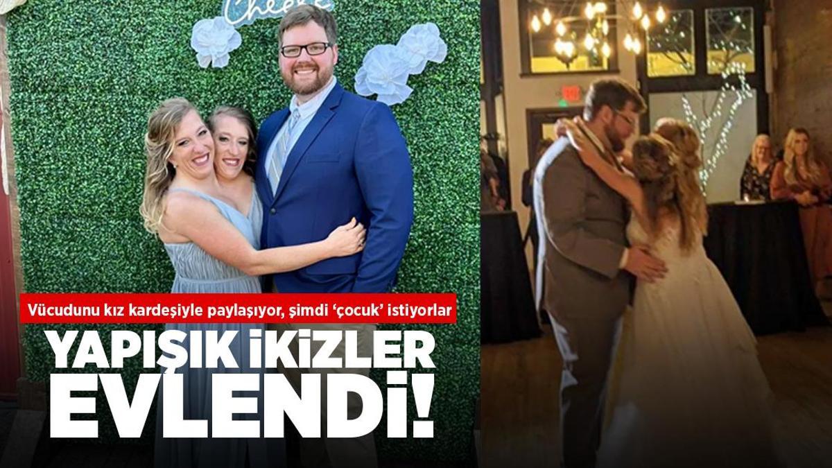 Ünlü yapışık ikizler evlendi! Vücudunu kız kardeşiyle paylaşıyor, şimdi ‘çocuk’ istiyorlar