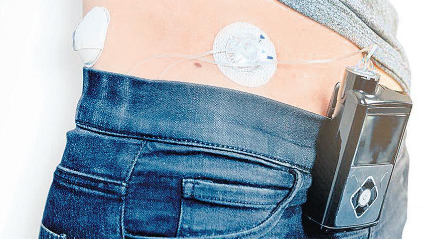 Dünyada ilk yapay pankreas dağıtımı