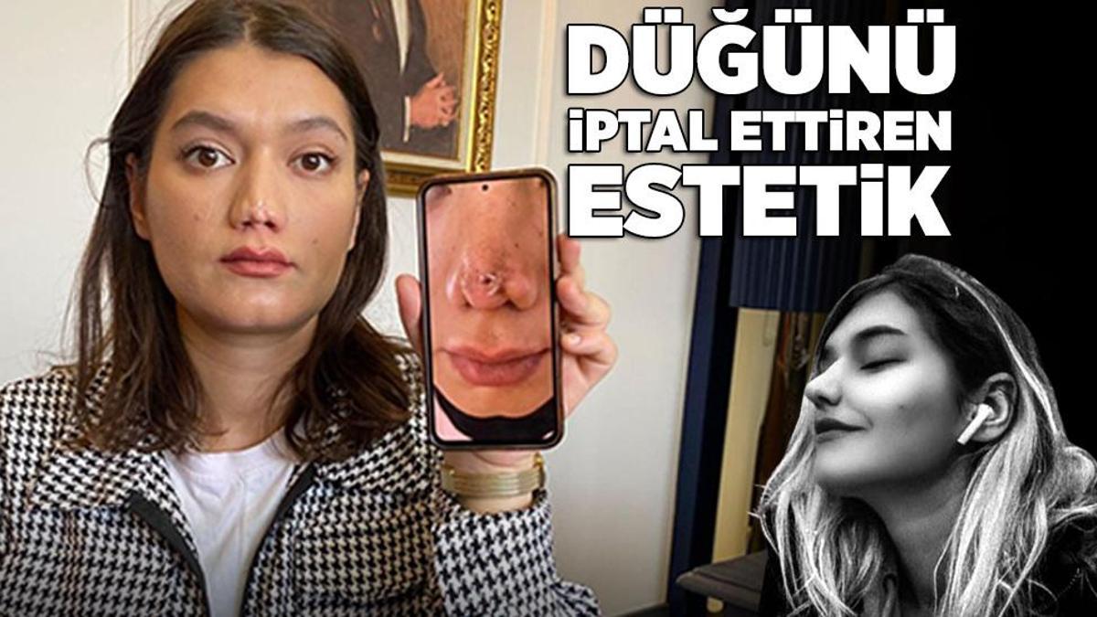 Düğünü iptal ettiren estetik! Doktordan skandal sözler: Sen de ne kadar şanssızsın