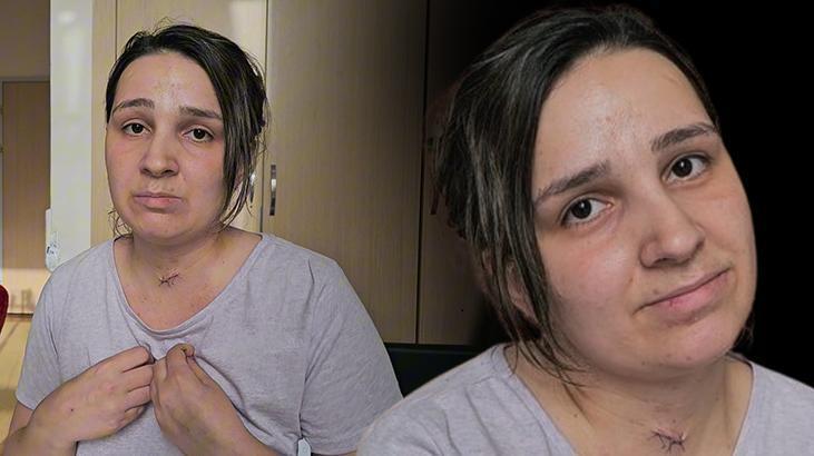 Yaşadığı cehennemi anlattı: Bana ‘mucize kadın’ diyorlar artık