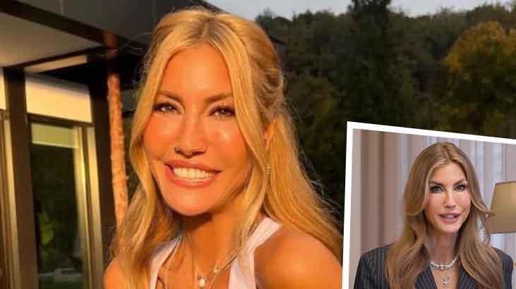 Çağla Şıkel’in dudaklarındaki değişim şaşırttı! ‘Ne yaptın kendine?’