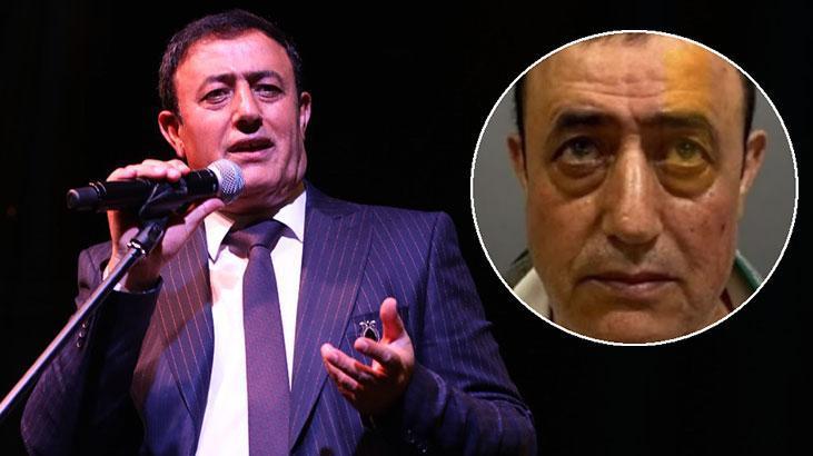 Mahmut Tuncer estetik yaptırdı! ‘Sen de mi Brütüs?’
