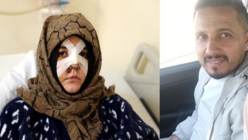 “Boşanma Süreci Kanlı Bitti: Eşine Kaldırım Taşıyla Saldırı Davası Ağır Ceza Yolunda”