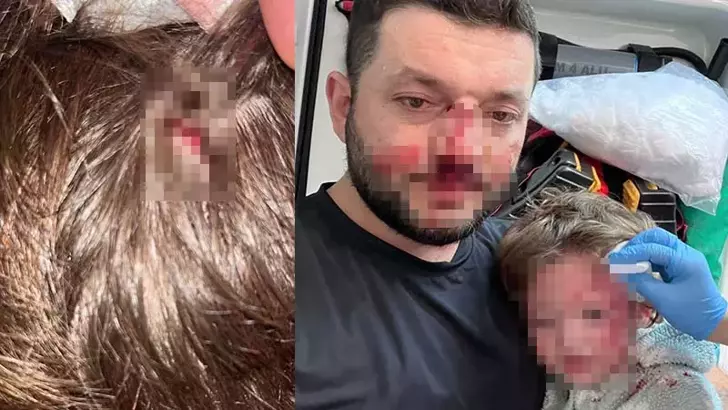 Yalova’da Komşu Kavgası: Bebek ve Baba Yaralandı, Sanık Tutuklu Yargılanıyor