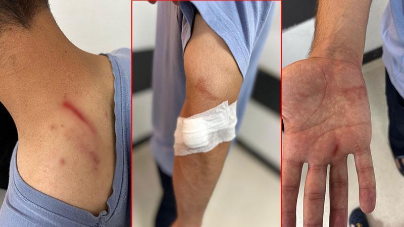 Hastanede tıbbi sekretere darp; hasta gözaltına alındı