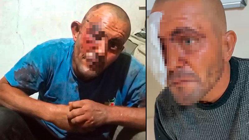 Sosyal medyada dans videolarıyla tanınan Selçuk Demir darbedildi